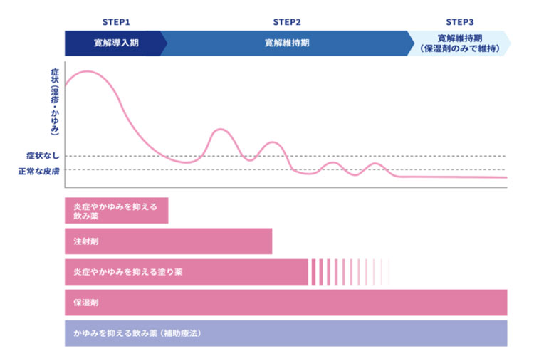 治療ステップの図